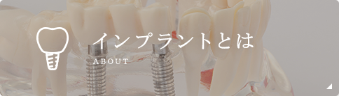 インプラントとは about